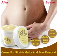 2pcs thailand pasjel precious skin body cream afy stretch marks remover scar removal powerful postpartum obesity pregnancy cream