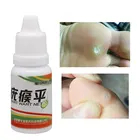 Аппарат для удаления бородавок на коже ног, 12 часов, удаление черных точек и бородавок