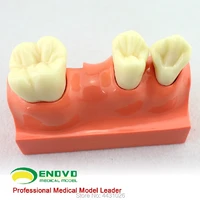 enovo dental anatomical model of dental anatomy model