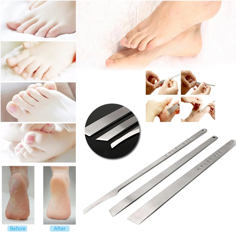 Набор инструментов для ухода за ногами 3 шт./компл. скребок удаления омертвевшей