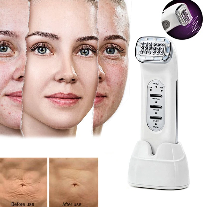 Термаж радиочастотные волны радио массажер для лица Частотный омоложения кожи