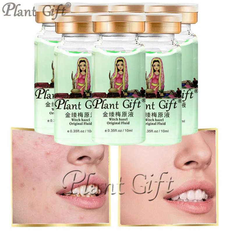 Завод подарок Лидер продаж гамамелиса исходном Жидкость против морщин