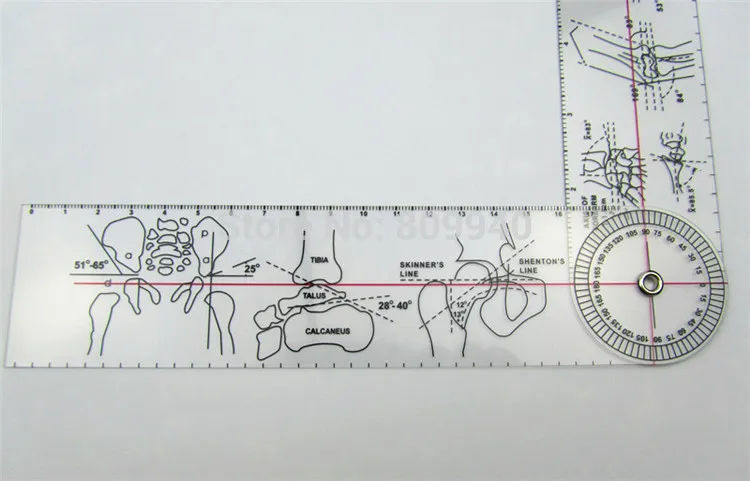 5 шт./лот! Спинальный Гониометр Дистальный радиулярный шарнир линейка