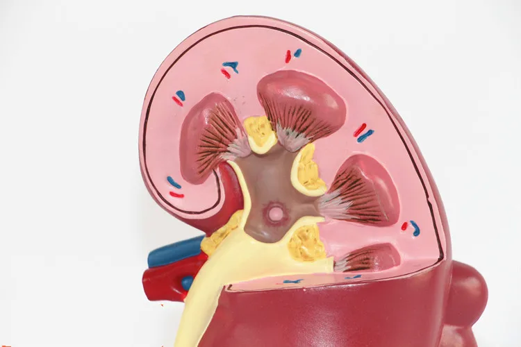 Модель анатомических заболеваний почек для человека LifeSize урология нефрон модель