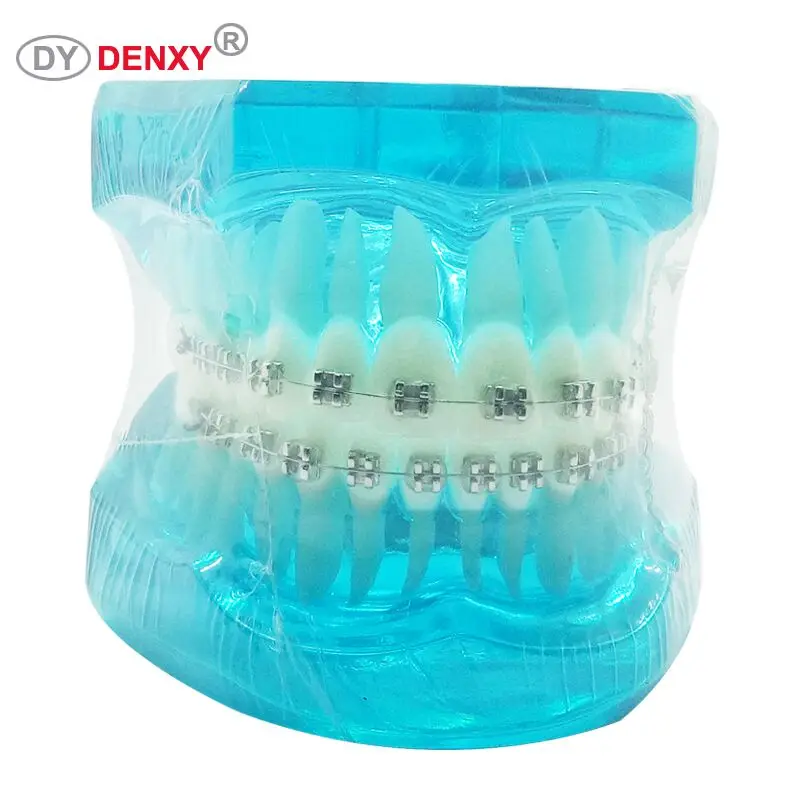 Denxy 1 шт. Ортодонтическая модель для пациента обучающая зубная Чистка инструкция модель с зубной скобкой стоматолога обучающий стоматологический инструмент - Цвет: Синий