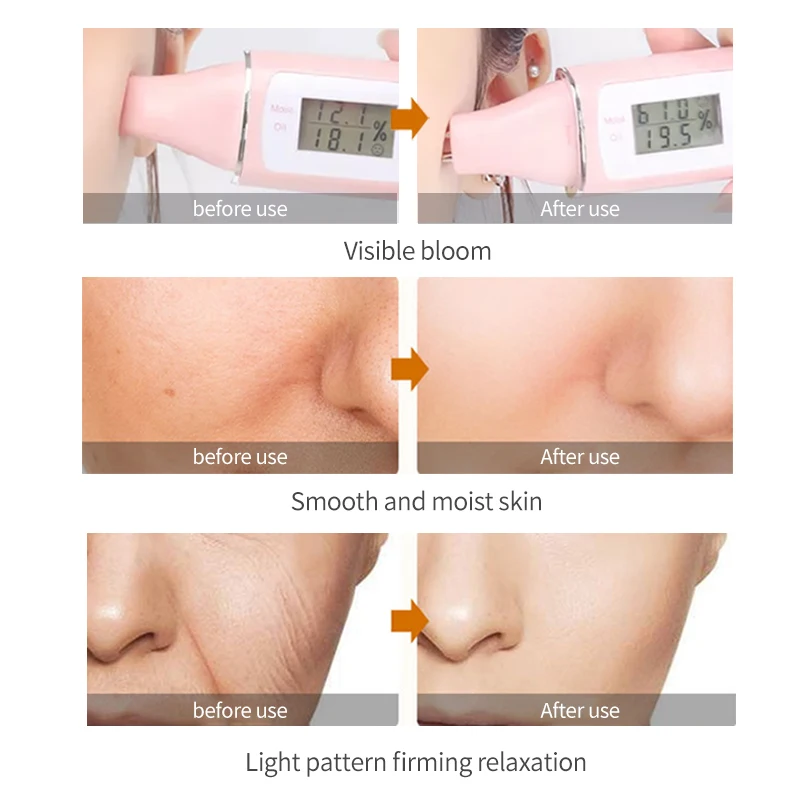 Увлажняющий крем для лица creme face hidratante anti envelhecimento Lifting отбеливающее омолаживающее