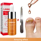Эссенция LANBENA для лечения грибка ногтей, Масло для кутикулы, 15 мл, антигрибковое Восстанавливающее Средство для ногтей, удаление грибка пальцев, онихомикоз, уход за ногтями
