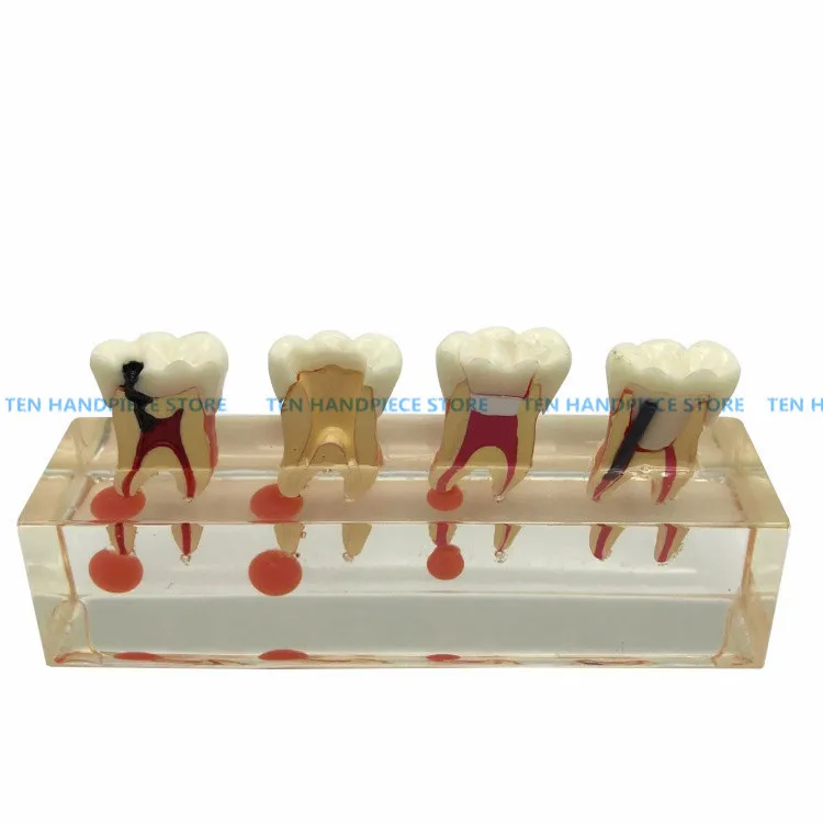 

2019 good quality Dental Oral Teaching Model Endodontic Treatment Model Demonstrating the process of deciduous teeth