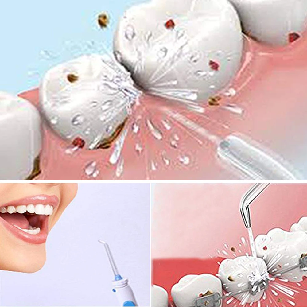 

4Pcs/Set Water Flosser Replacement Jet Tips Oral Flossers Irrigator Tips For Waterpik Sealed Tooth Care Tool Standard Size