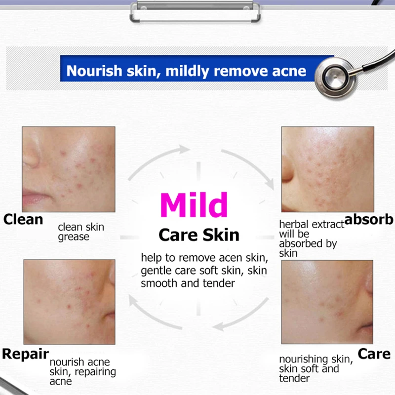 Anti Acne Serum Remove Blackhead Eliminates Scar Acne Treatment Moisturizing Oil Control Shrink Pore Pimple Blemish Essence 30ML