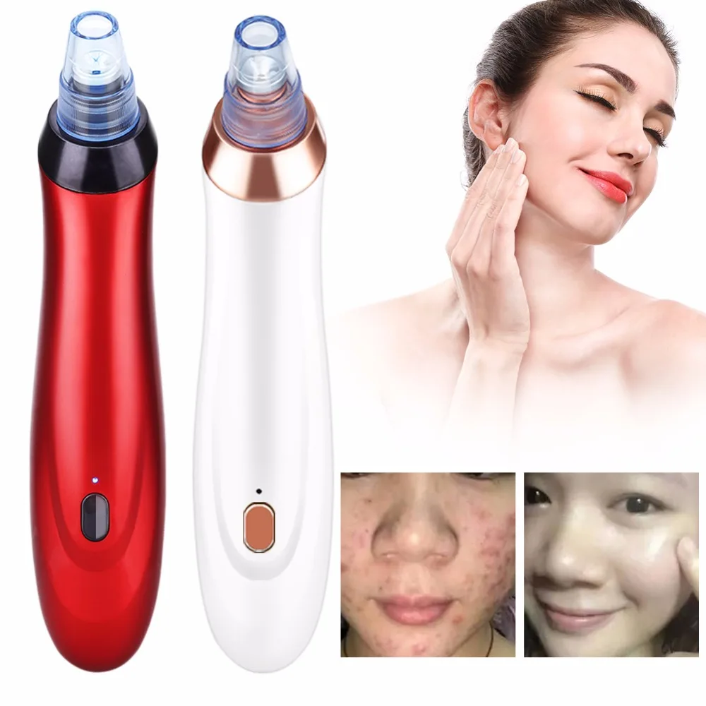 2 Цвета вакуумный Черноголовых всасывания удаления прыщей уход за кожей