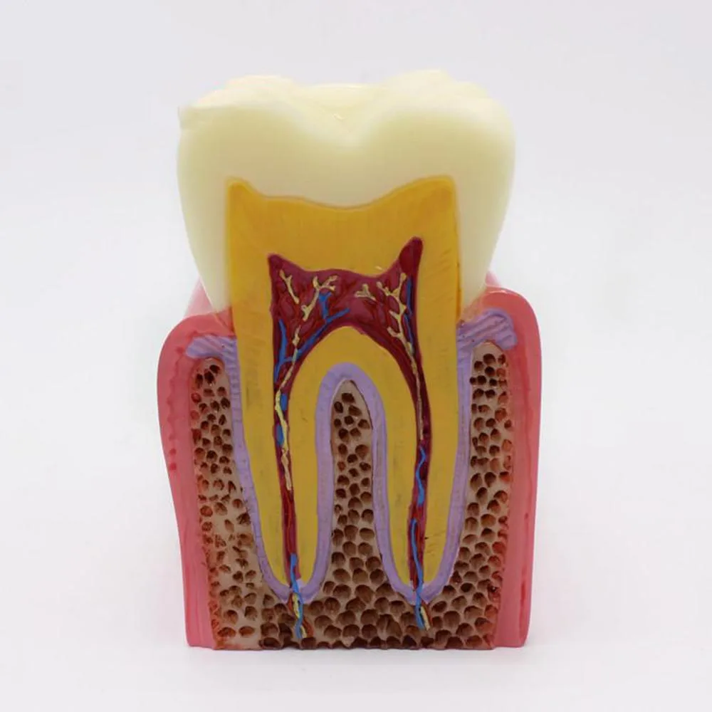 Фото Зум 6X зум модель кариеса стоматологический пациент общение анатомия