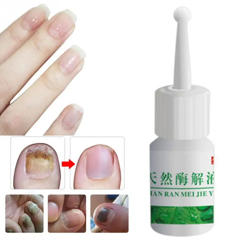 Новый Уход за ногтями травяные ногтей ремонт крем анти грибковые китайская