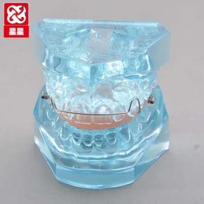 

Functional Appliances model Dentistry teaching Patient communication model free shipping