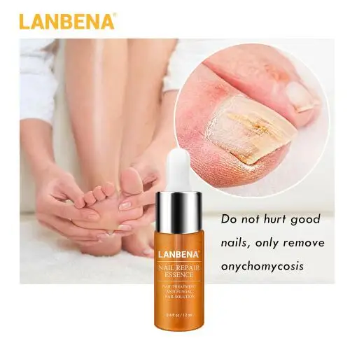 LANBENA nail repair essence serum Nail treatment of the fungus remove Onychomycosis feet nourishing brightening hand and foot ca |
