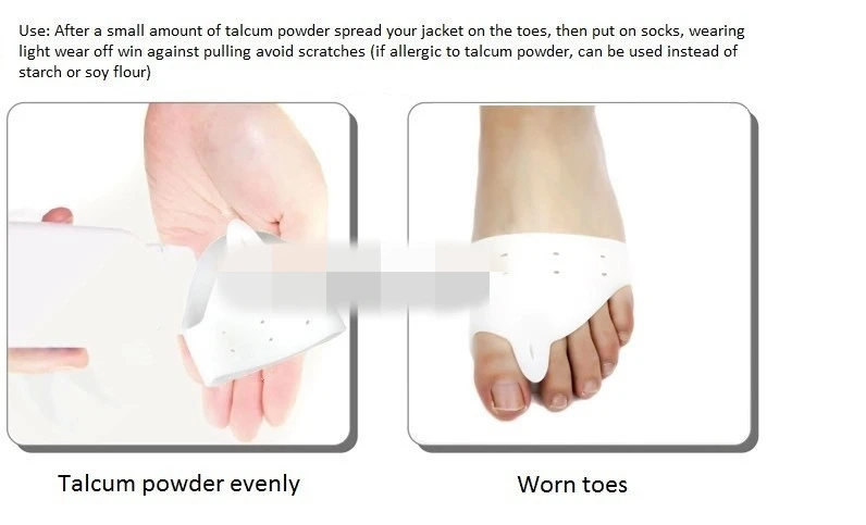 2017 2 шт вальгусная деформация силиконовый разделитель пальцев большой корректор