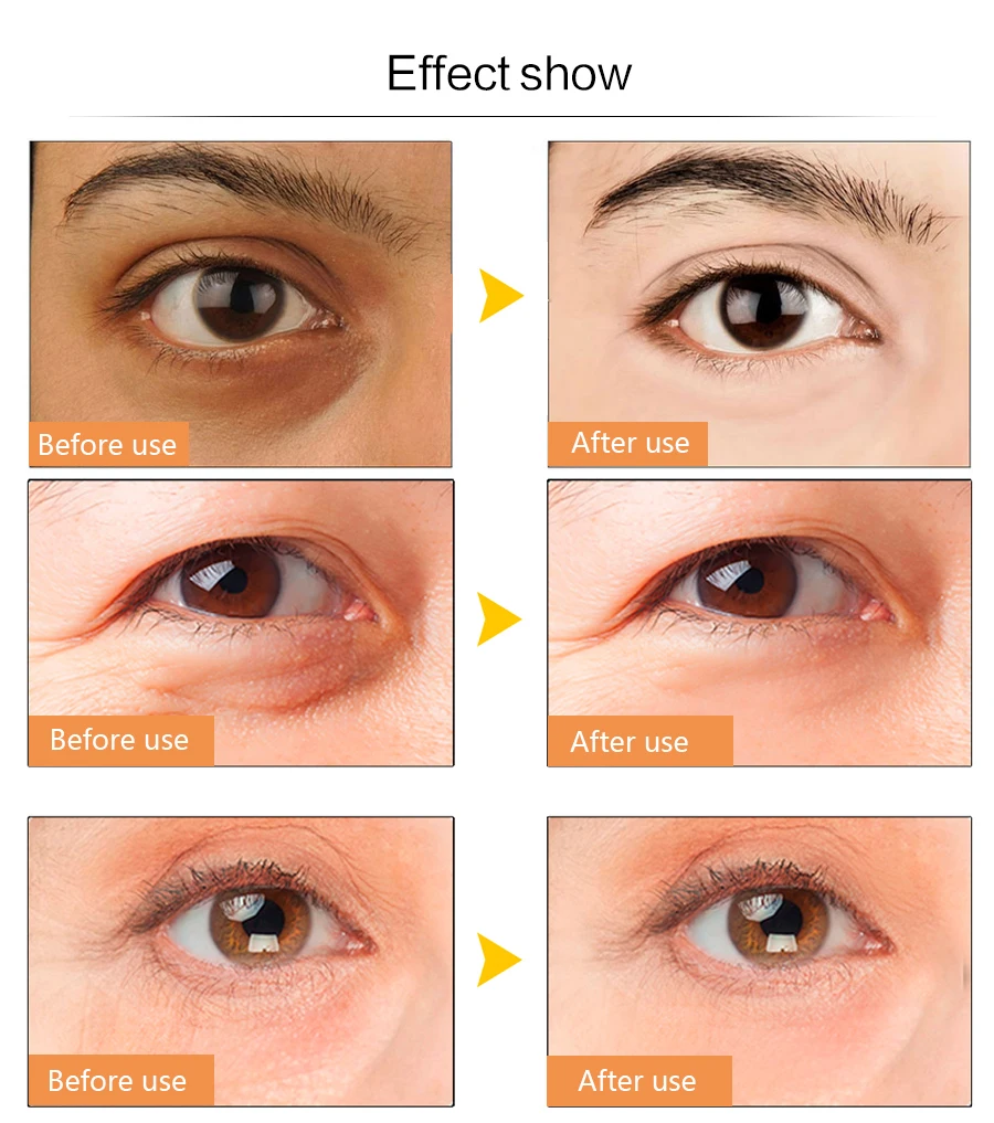 

efero 10packs Eye Cream Anti Wrinkle Remove Dark Circles Eye Bags Repair Under Eye Cream Face Cream Eyes Serum