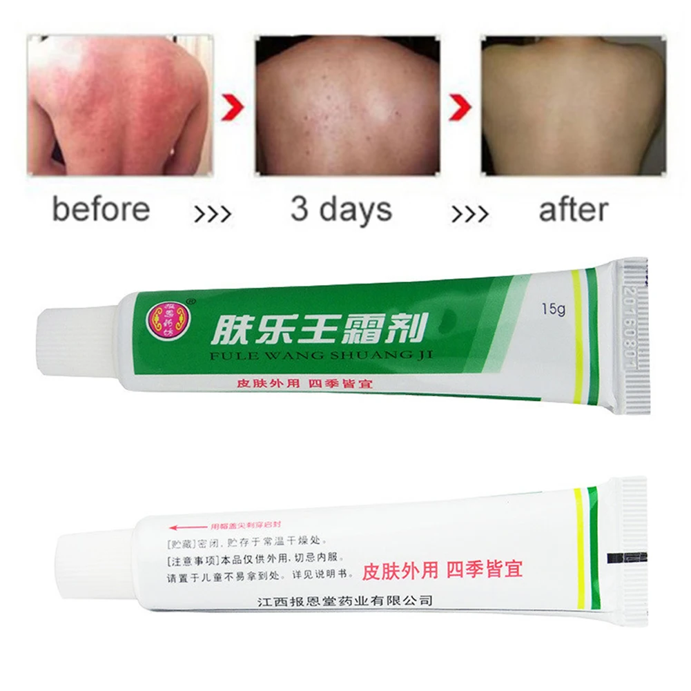 100% оригинальный крем от псориаза кожи дерматит экзематоид экзема мазь лечение