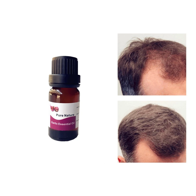 

Garlic Oil Hair Care Treatment Essential oil Fast Powerful Hair Growth Liquid Hair Loss Serum Repair Hair Keratine Herbal 10ml