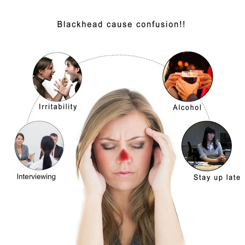 Черная Минеральная Грязь черные точки на носу маски от акне против черных точек