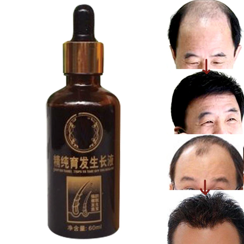 

Hair Growth Serum Chinese Medicine Recipe Germinal Fluid Anti-hair Loss. Hair Loss Additional Effects Dense Hair Invalid Refund