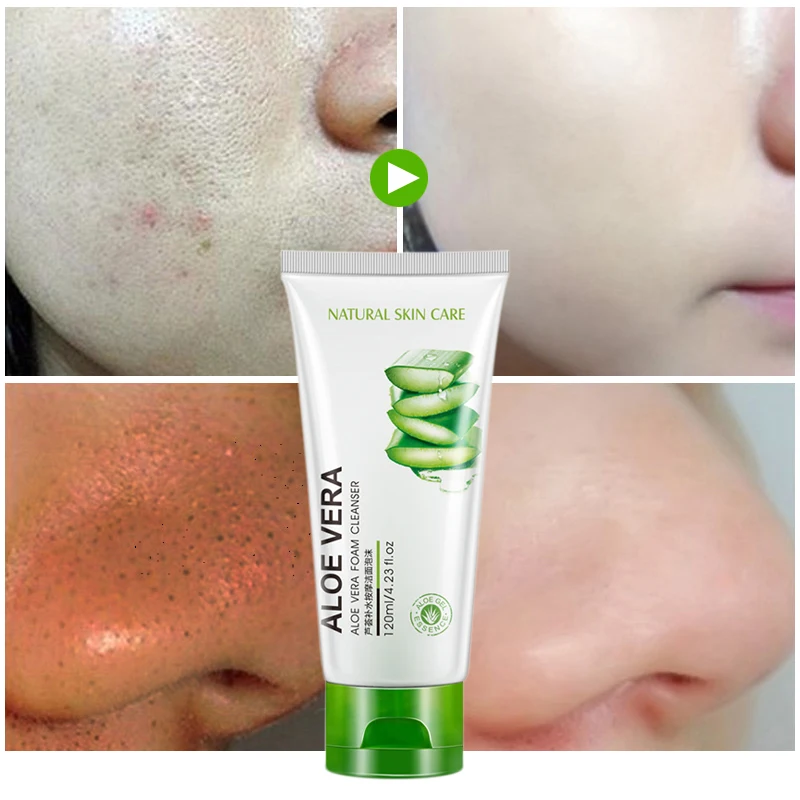 ROREC алоэ вера Очищающий тоник для кожи уход за растением экстракт коллагена