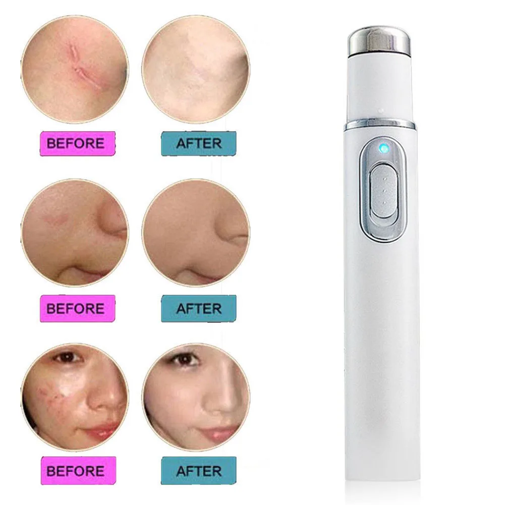 Soft Therapy Acne Laser Pen Blue Light Durable Face Skin Care Tools Massage Portable Scar Remover Machine KD-7910 |