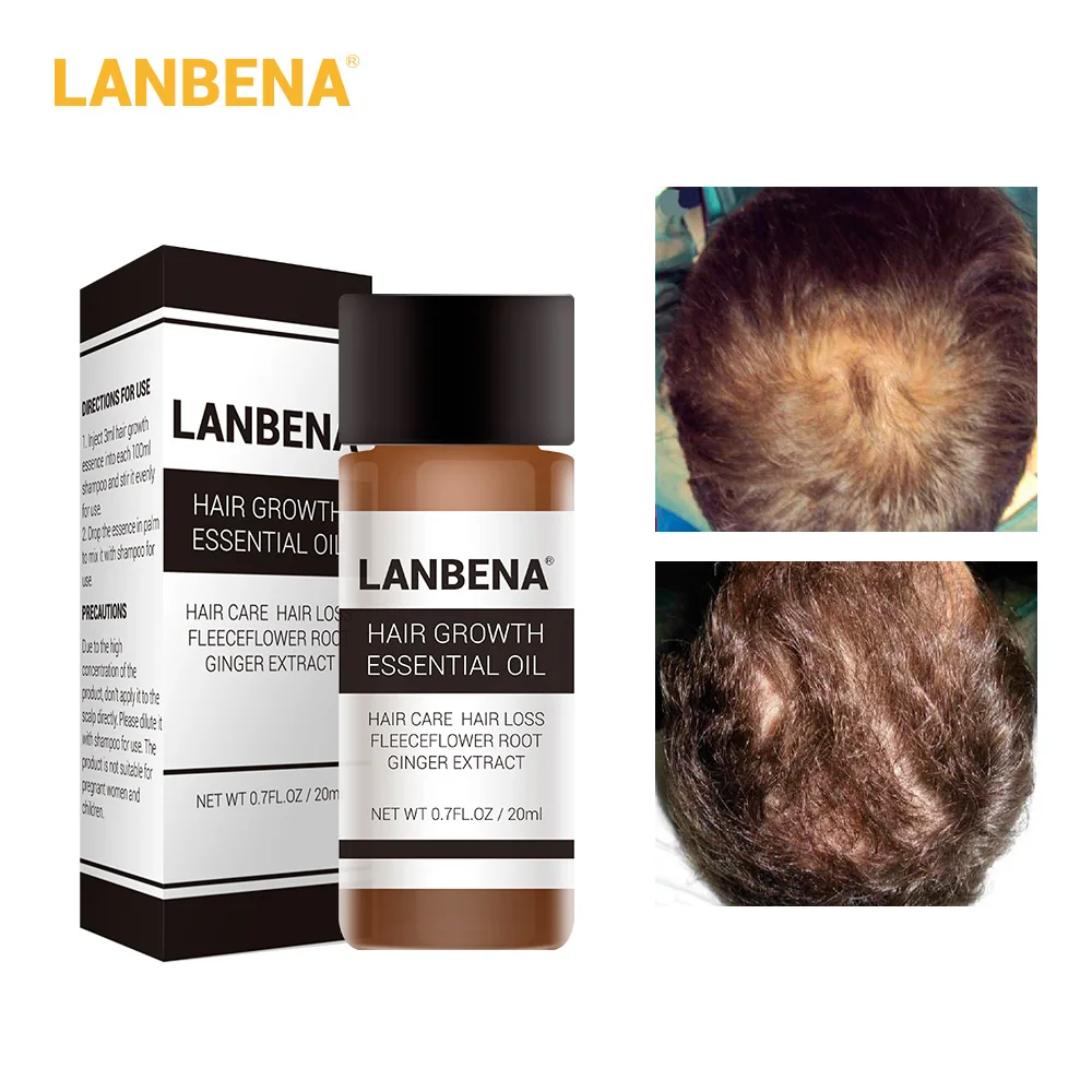 LANBENA быстро мощные средства с эссенцией для рост волос Эфирное Масло жидкое