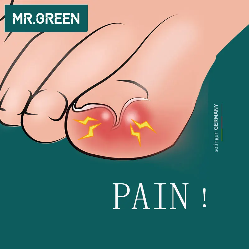 Кусачки MR.GREEN для вросших и толстых инструмент для педикюра, профессиональные кусачки для ногтей из нержавеющей стали, острый маникюр, тримм... от AliExpress WW