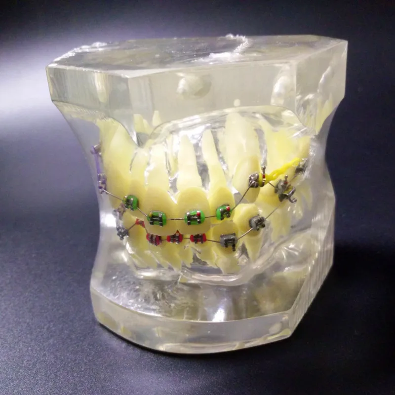 

2PC Transparent Dental Orthodontic Mallocclusion Model with Brackets Archwire buccal tube Tooth Extraction for Patient Communica