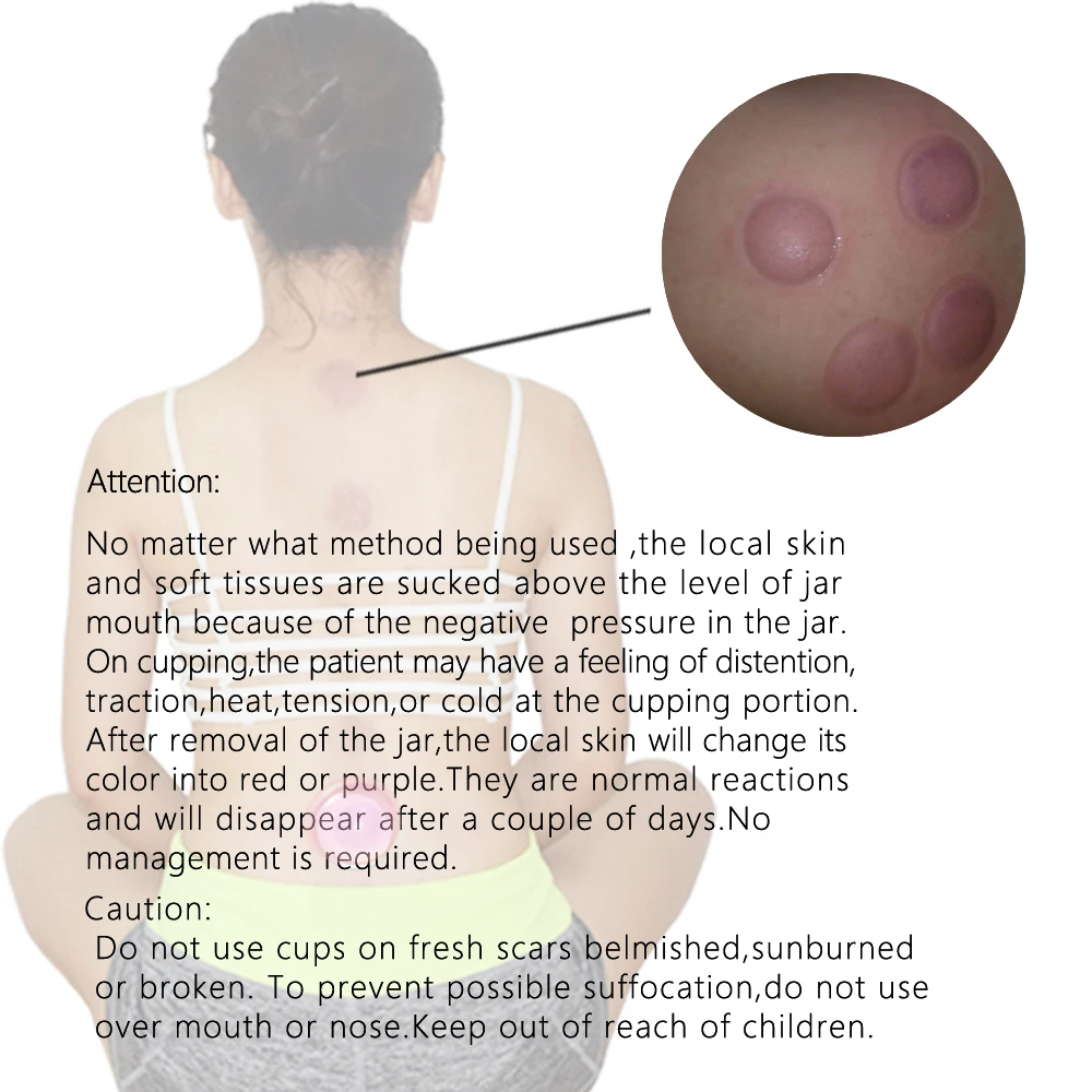 

2019 New 6Pcs Massage Cup Vacuum Massage Silicone Cups Massage Body Neck Facial Massager Cup Set Ventouse Cellulite