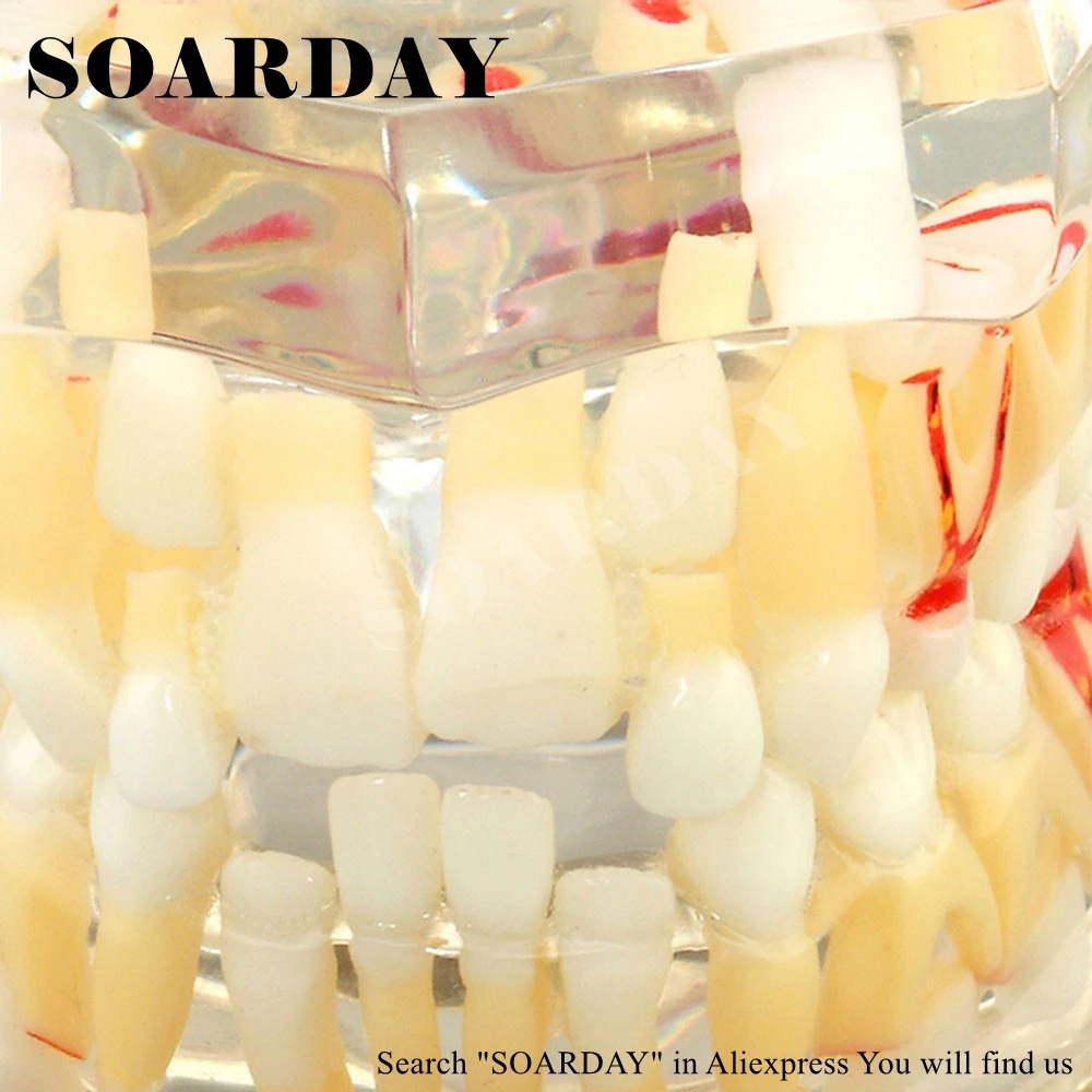 

SOARDAY Child Primary Teeth Alternative Model Deciduous Teeth Nerve Display Tooth Replacement