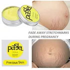 Крем для удаления рубцов от акне, растяжки, крем для удаления рубцов от акне, лечение жира, рубцов, 20 г