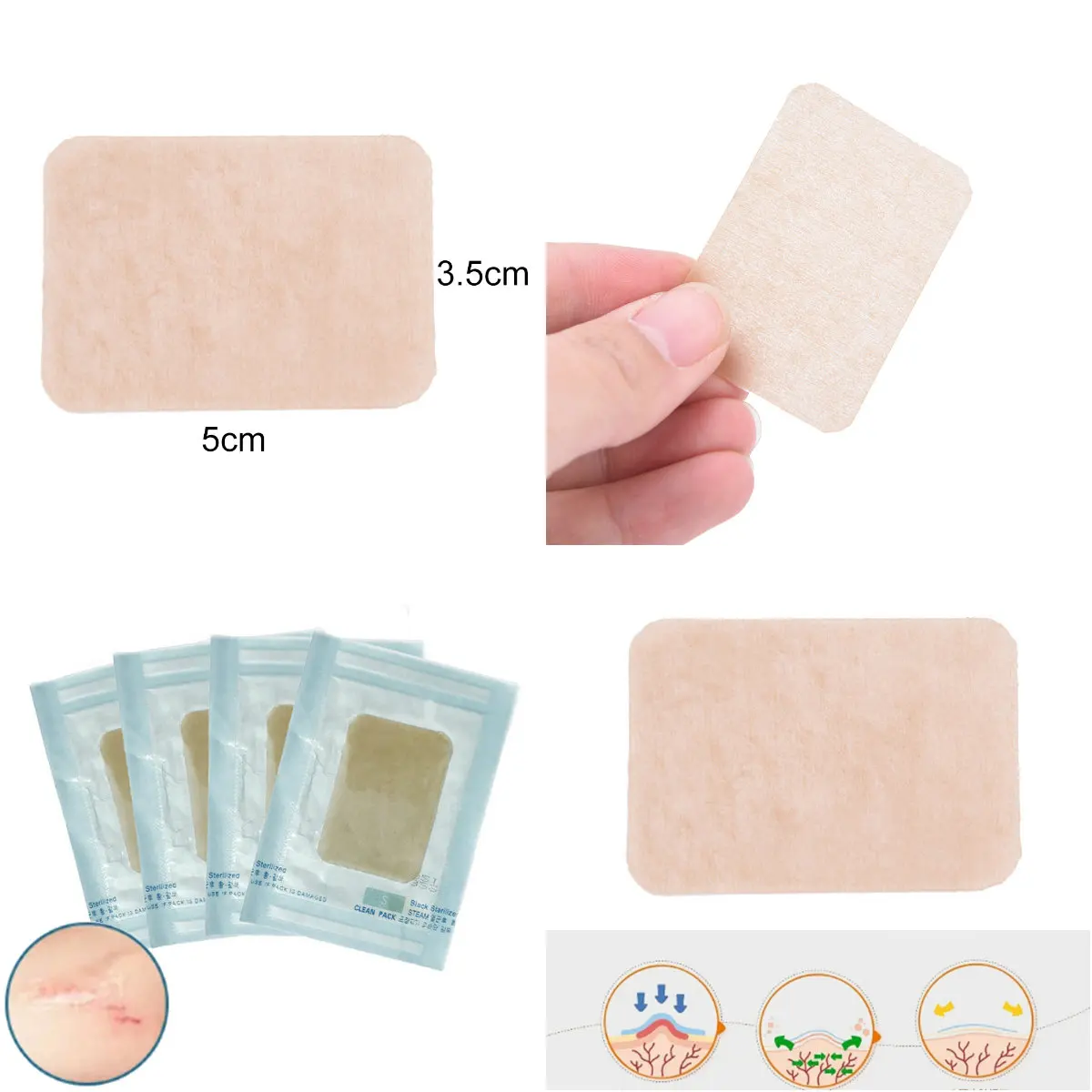 Цветная кожа шрамы от шрамов Ранняя терапия лечение рубцов келоидные 5 см x 3 2