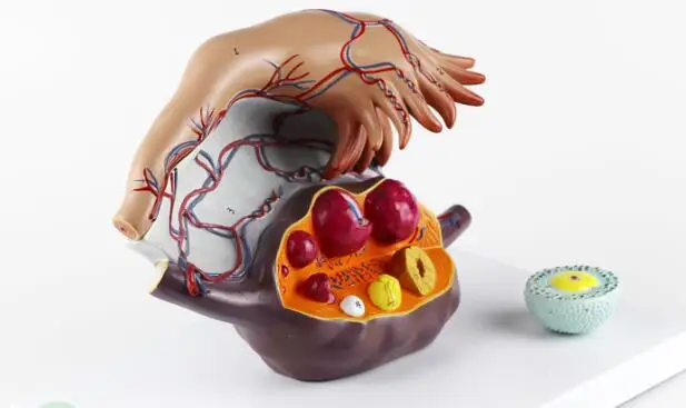 

Medical Anatomy Model of Female Enlarged Ovary Brand 35*24*24CM 120