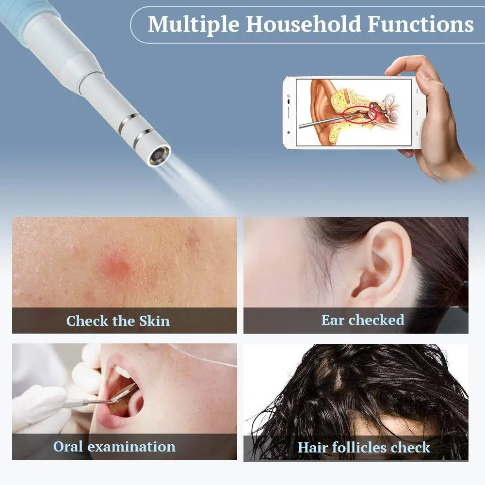 1.3MP 3 In 1 USB OTG Visual Ear Cleaning Endoscope Spoon Functional Diagnostic Tool Cleaner Android 720P Camera Pick | Электроника