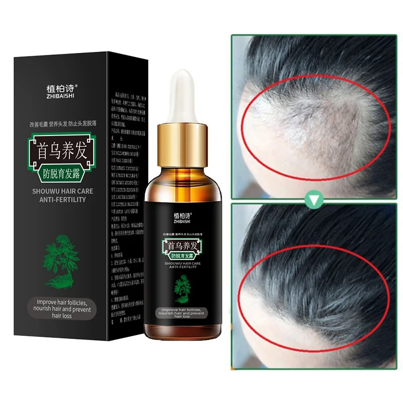 7 дней роста волос Эфирные масла против выпадения Жидкая Сыворотка для густых