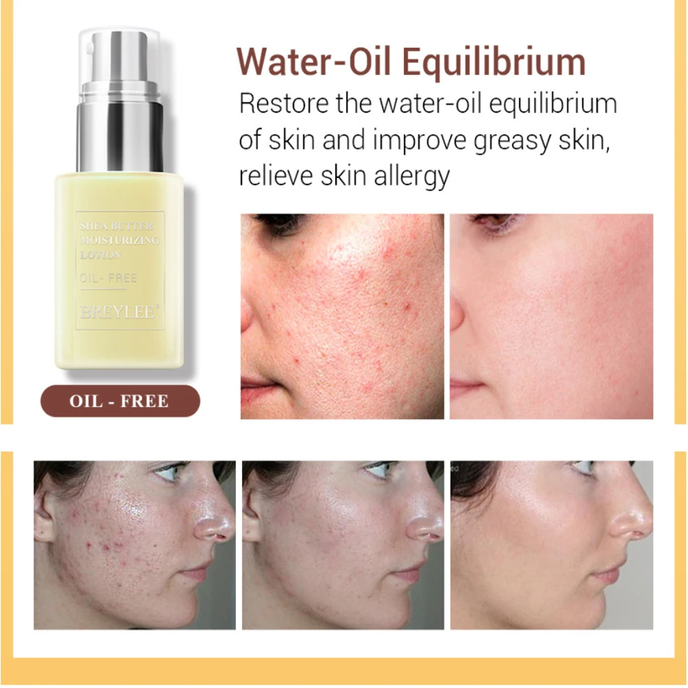 Face Cream Skin Care Anti Acne Treatment Facial Hydratante Shea Butter Moisturizing Lotion Repair Emulsion Day Night | Красота и
