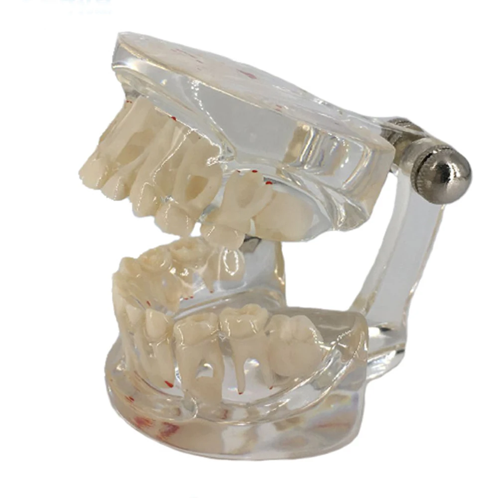 Модель зубного протеза для детей стандартная прозрачная демонстрационная