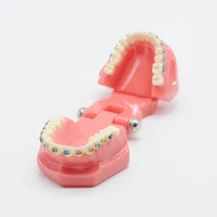 dentist orthodontic mallocclusion teeth model with bracket archwire buccal tube for dental lab supplies