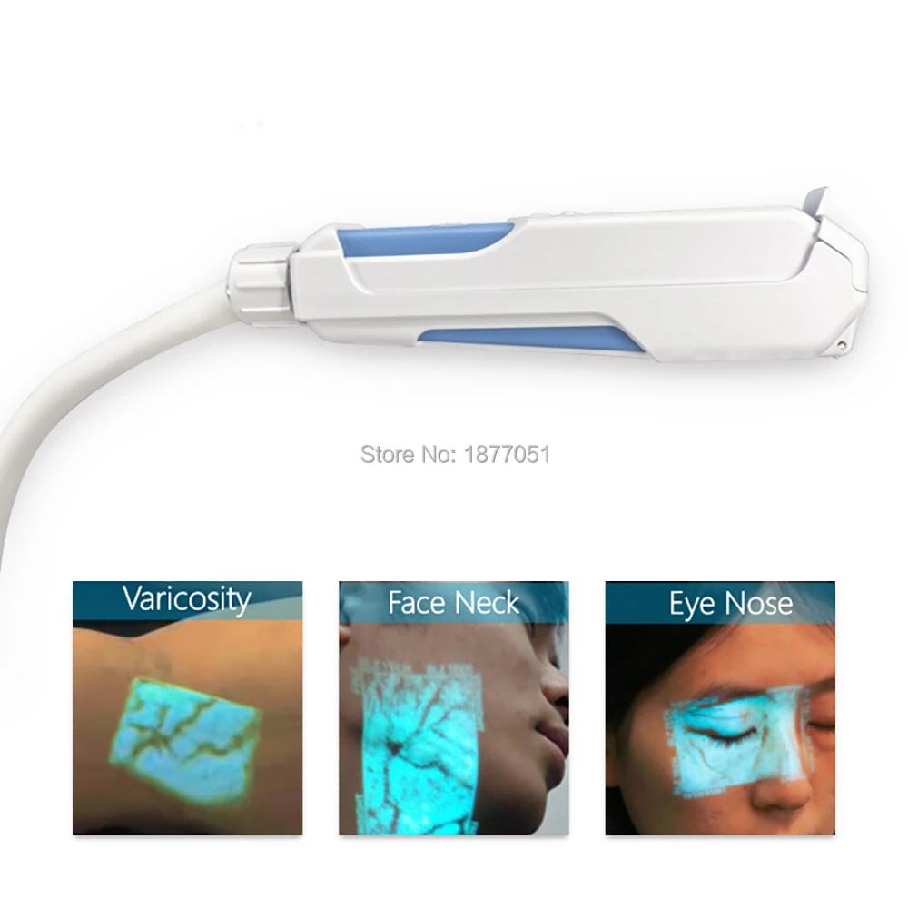 

Hospital Injection Vein Locator Clinic Easy Use for Doctors Nurses