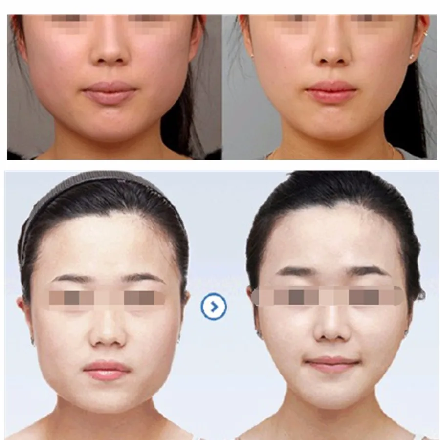 3D Силиконовый гель для сна, тонкая, для похудения, для лица, для ухода за лицом, для подтягивания кожи, лента, пилинг, маска, двойной пояс для подбородка, v-образная форма, лифтинг, инструмент для красоты