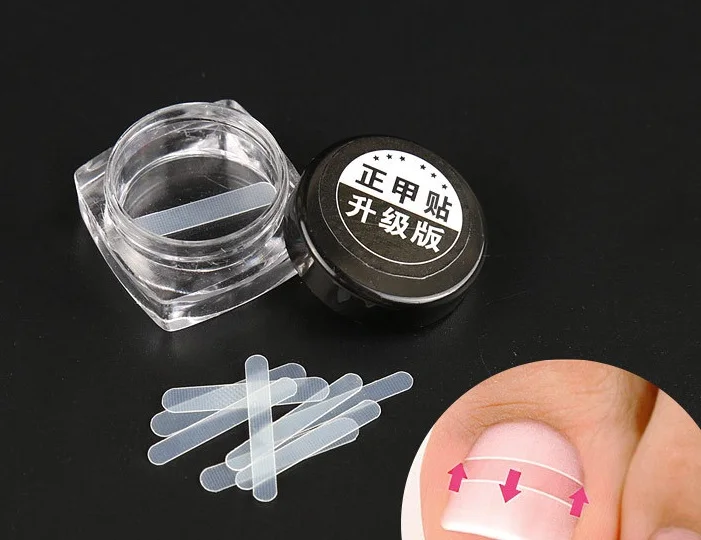 NEW 10pcs/box Fixer Pedicure Recover Ingrown Sticker Patch Foot Care Toe Nail Tool Correction File Acronyx Bunion Wire Corrector | Красота и