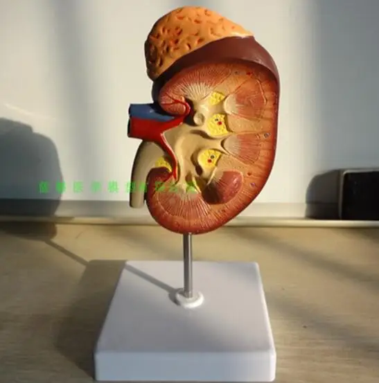 Почек модель с адреналовыми 2 кратное увеличение почек тканей человеческого тела