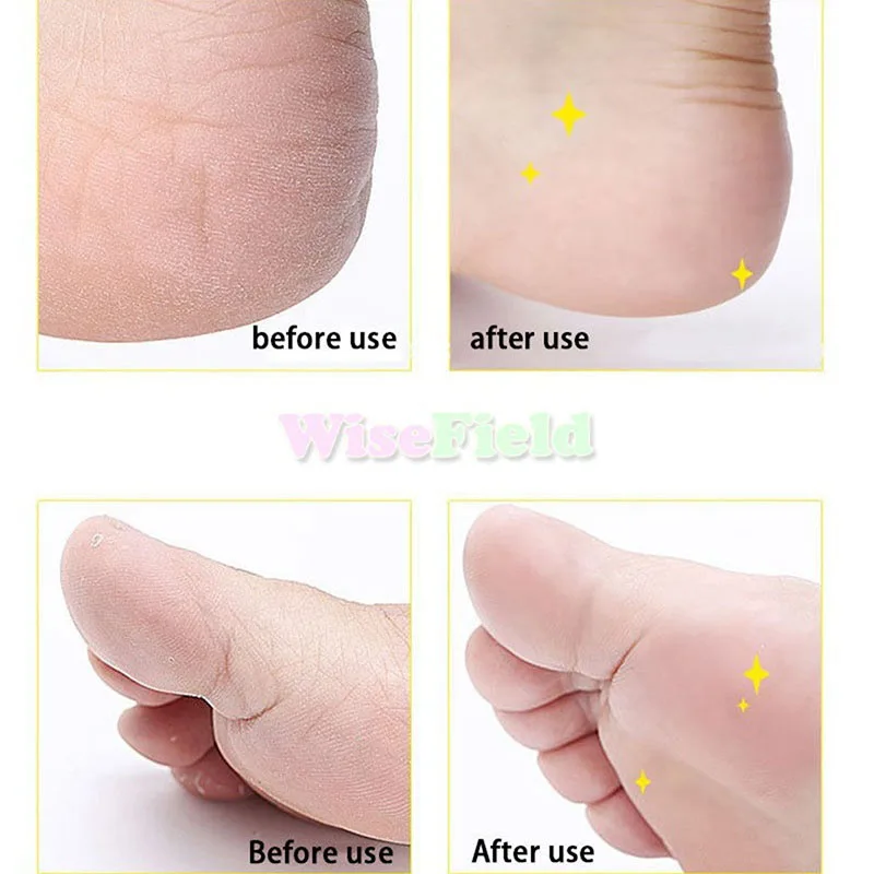 2 шт. инструмент для ухода за ногами удаления кожи замена заправок|Электрические