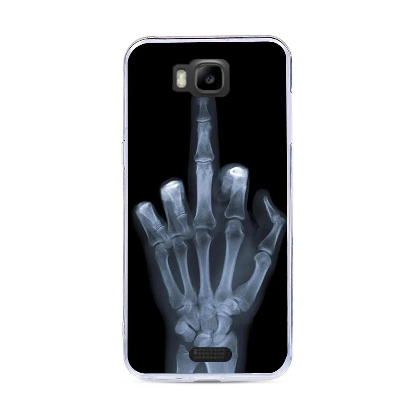 J&ampR Pattern Phone Case For Huawei Y541 y560-u02Silicone Soft TPU Cover for Honor Bee y541 y541-u02/Y5C Cases |