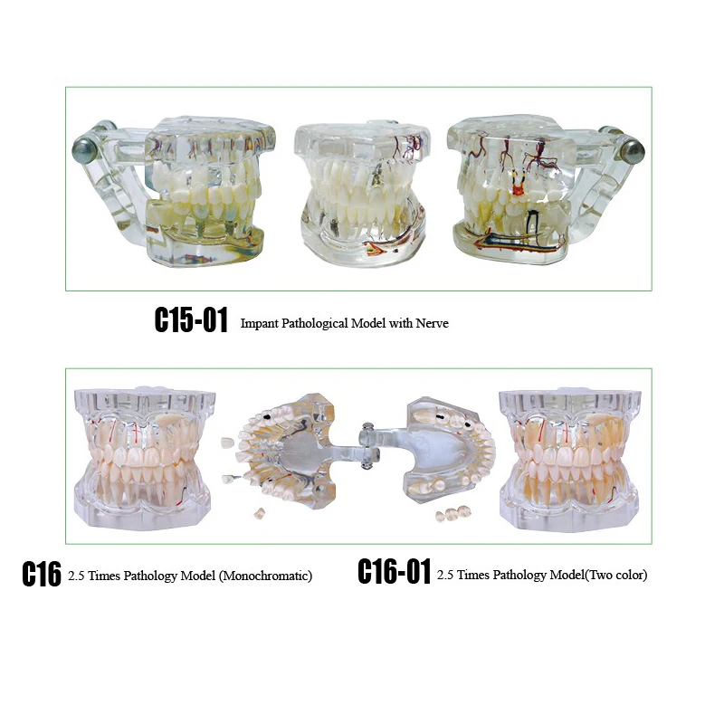 

Dental implant pathological model with nerve 2.5times dental pathology teeth model for dental Exercises