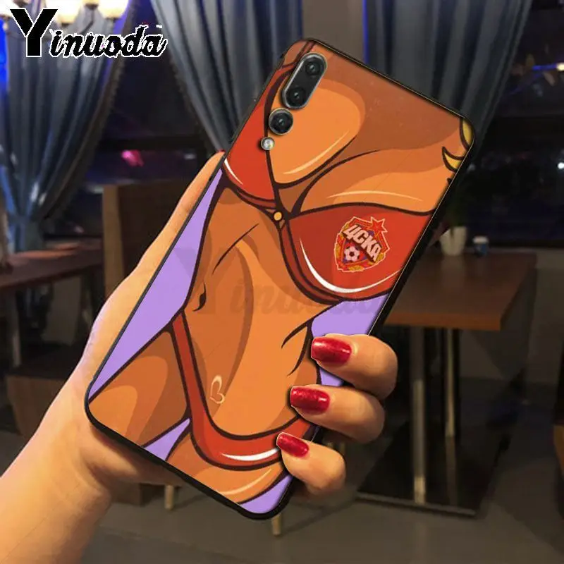 Yinuoda сексуальный женский Мягкий чехол для huawei p30 pro p20lite mate10pro nova 3i mate20 p20