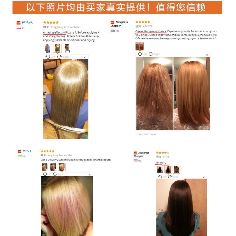 Новый профессиональный набор для ухода за волосами имбирный шампунь 101 против