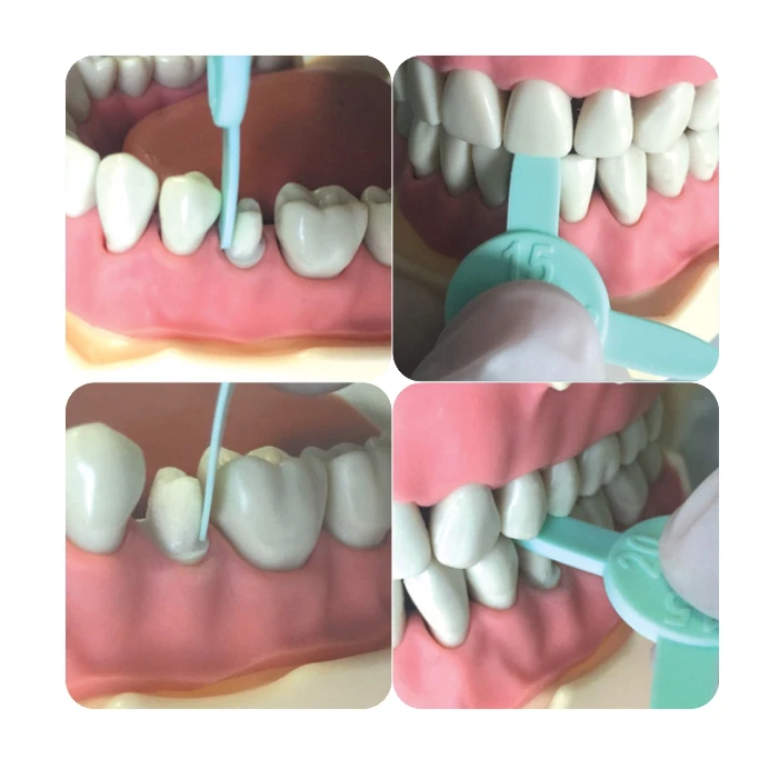 4 шт./компл. измерительная линейка для подготовки зубов occlusal